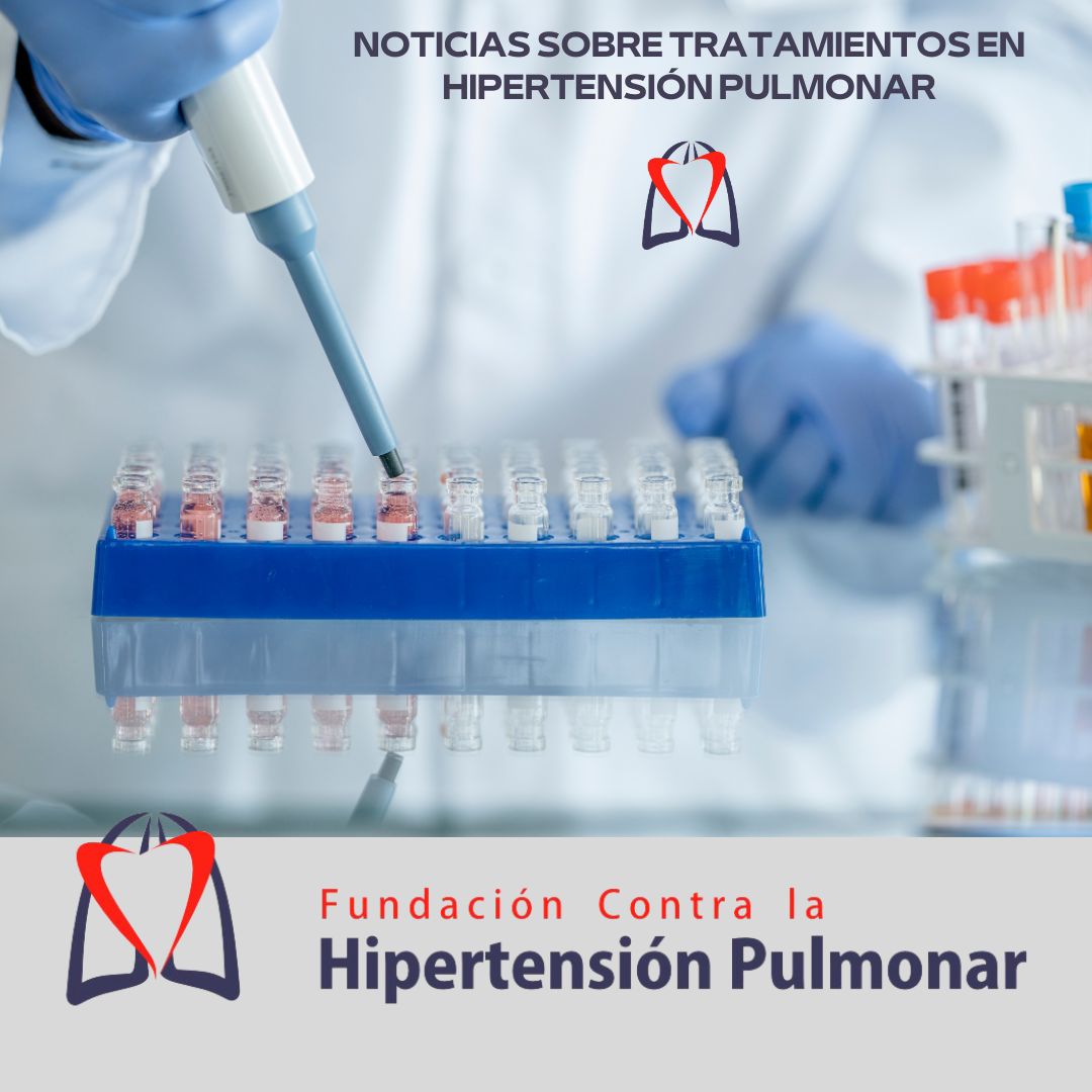 TRATAMIENTOS HIPERTENSIÓN PULMONAR