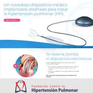 Dispositivo Implantable Para Hipertensión Pulmonar Reduce Carga De Trabajo Cardíaca Y Mejora Flujo Sanguíneo