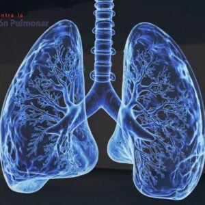 Ensayo Clínico Fase 3: Seralutinib Para Hipertensión Pulmonar Asociada A Enfermedad Pulmonar Intersticial (PH-ILD)